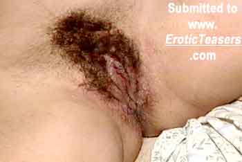 Erotic Teasers hairy pussy sleeper 01i